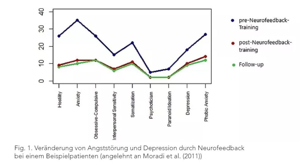 Angststörung Neurofeedback